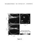 PLANNING SYSTEM FOR TARGETING TISSUE STRUCTURES WITH ULTRASOUND diagram and image