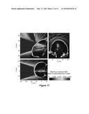 PLANNING SYSTEM FOR TARGETING TISSUE STRUCTURES WITH ULTRASOUND diagram and image