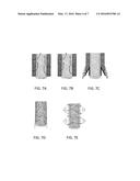 FILTER PLATE, FILTER DISC APPARATUS, AND A METHOD FOR CONTROLLING A DISC     FILTER diagram and image