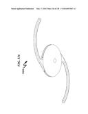 INTRAOCULAR LENS (IOL) FABRICATION SYSTEM AND METHOD diagram and image
