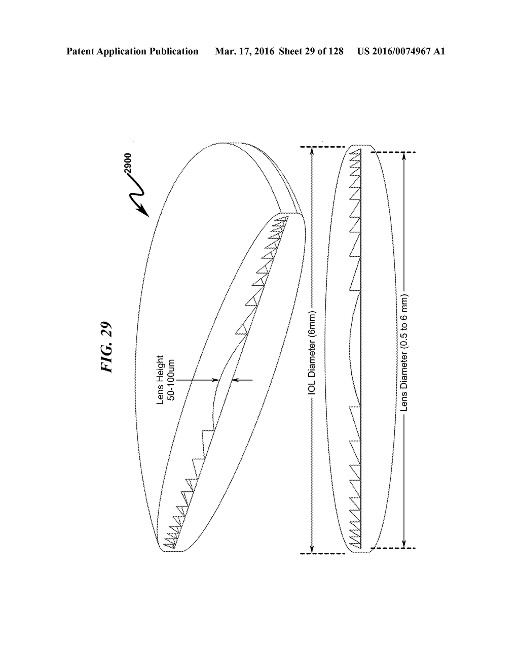 INTRAOCULAR LENS (IOL) FABRICATION SYSTEM AND METHOD - diagram, schematic, and image 30