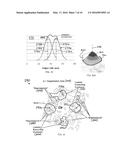 CHEMICAL MECHANICAL PLANARIZATION PAD CONDITIONER diagram and image