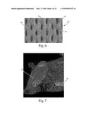 Method Of Making Nonwoven Material Having Discrete Three-Dimensional     Deformations With Wide Base Openings That are Tip Bonded to Additional     Layer diagram and image
