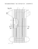 Method Of Making Nonwoven Material Having Discrete Three-Dimensional     Deformations With Wide Base Openings That are Tip Bonded to Additional     Layer diagram and image