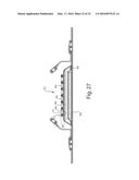 Method Of Making Nonwoven Material Having Discrete Three-Dimensional     Deformations With Wide Base Openings That are Tip Bonded to Additional     Layer diagram and image