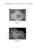 Method Of Making Nonwoven Material Having Discrete Three-Dimensional     Deformations With Wide Base Openings That are Base Bonded to Additional     Layer diagram and image