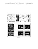 COMPOSITIONS AND METHODS FOR CHEMICAL EXCHANGE SATURATION TRANSFER (CEST)     MAGNETIC RESONANCE IMAGING (MRI) diagram and image