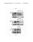 ANTI-ANGIOGENESIS COMPOUND, INTERMEDIATE AND USE THEREOF diagram and image