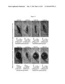 ANTI-ECTODYSPLASIN ANTIBODIES diagram and image