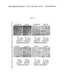 ANTI-ECTODYSPLASIN ANTIBODIES diagram and image