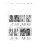 ANTI-ECTODYSPLASIN ANTIBODIES diagram and image