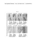 ANTI-ECTODYSPLASIN ANTIBODIES diagram and image