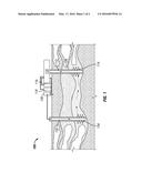 FORMATION PRECONDITIONING USING AN AQUEOUS POLYMER PREFLUSH diagram and image