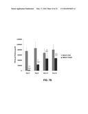 siRNA Therapy for Transthyretin (TTR) Related Ocular Amyloidosis diagram and image