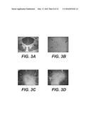 MOLECULAR TARGETS FOR ALS AND RELATED DISORDERS diagram and image