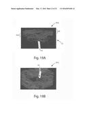 Nonwoven Material Having Discrete Three-Dimensional Deformations That Are     Configured To Collapse In A Controlled Manner diagram and image