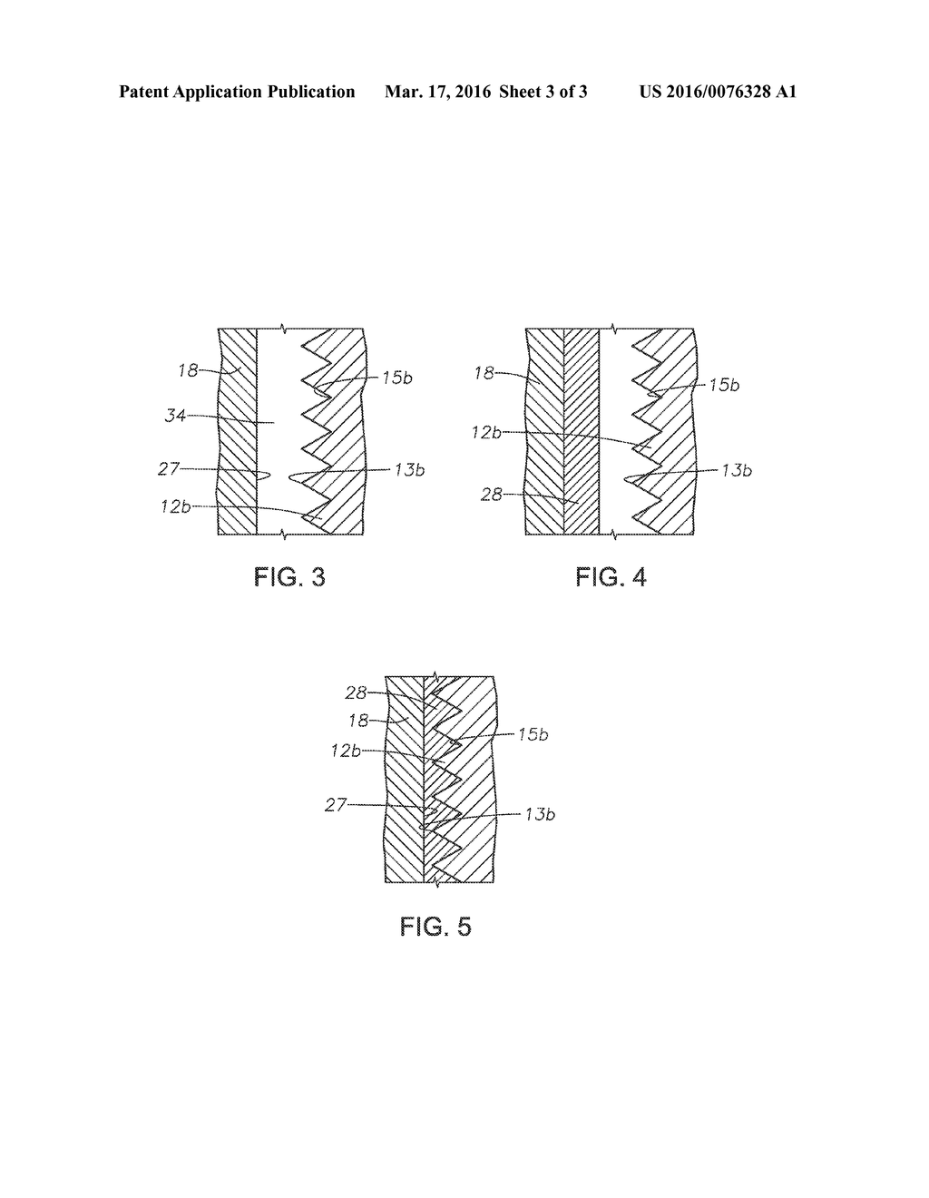 Seal With Soft Material Inlay - diagram, schematic, and image 04