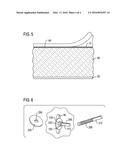 DAMPING DESIGN TO REDUCE VIBRATORY RESPONSE IN THE TURBINE EXHAUST     MANIFOLD CENTERBODY diagram and image