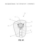 VARIABLE LOST MOTION VALVE ACTUATOR AND METHOD diagram and image