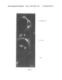 METHODS FOR DETECTING EHRLICHIA INFECTION diagram and image