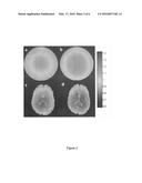 METHODS AND APPARATUS FOR ACCURATE CHARACTERIZATION OF SIGNAL COIL     RECEIVER SENSITIVITY IN MAGNETIC RESONANCE IMAGING (MRI) diagram and image