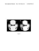 METHODS AND APPARATUS FOR ACCURATE CHARACTERIZATION OF SIGNAL COIL     RECEIVER SENSITIVITY IN MAGNETIC RESONANCE IMAGING (MRI) diagram and image