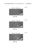 SYSTEMS AND METHODS FOR IMAGING PHASE SELECTION FOR COMPUTED TOMOGRAPHY     IMAGING diagram and image