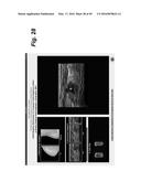 METHOD, SYSTEM, SOFTWARE AND MEDIUM FOR ADVANCED INTELLIGENT IMAGE     ANALYSIS AND DISPLAY OF MEDICAL IMAGES AND INFORMATION diagram and image