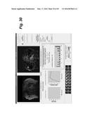 METHOD, SYSTEM, SOFTWARE AND MEDIUM FOR ADVANCED INTELLIGENT IMAGE     ANALYSIS AND DISPLAY OF MEDICAL IMAGES AND INFORMATION diagram and image