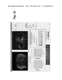 METHOD, SYSTEM, SOFTWARE AND MEDIUM FOR ADVANCED INTELLIGENT IMAGE     ANALYSIS AND DISPLAY OF MEDICAL IMAGES AND INFORMATION diagram and image