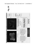 METHOD, SYSTEM, SOFTWARE AND MEDIUM FOR ADVANCED INTELLIGENT IMAGE     ANALYSIS AND DISPLAY OF MEDICAL IMAGES AND INFORMATION diagram and image