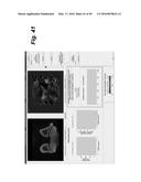 METHOD, SYSTEM, SOFTWARE AND MEDIUM FOR ADVANCED INTELLIGENT IMAGE     ANALYSIS AND DISPLAY OF MEDICAL IMAGES AND INFORMATION diagram and image