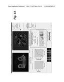 METHOD, SYSTEM, SOFTWARE AND MEDIUM FOR ADVANCED INTELLIGENT IMAGE     ANALYSIS AND DISPLAY OF MEDICAL IMAGES AND INFORMATION diagram and image