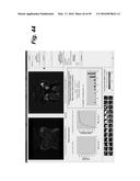 METHOD, SYSTEM, SOFTWARE AND MEDIUM FOR ADVANCED INTELLIGENT IMAGE     ANALYSIS AND DISPLAY OF MEDICAL IMAGES AND INFORMATION diagram and image