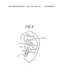 ACOUSTIC DEVICE diagram and image