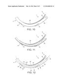 LARYNGOSCOPE INSERTION SECTION diagram and image