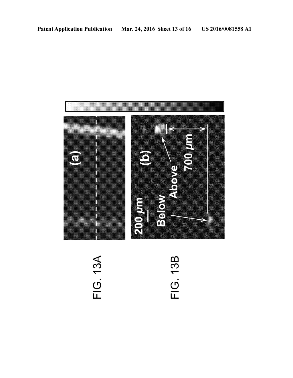 METHOD OF PHOTOACOUSTIC MICROSCOPY WITH LATERAL RESOLUTION OF     MICROVASCULATURE - diagram, schematic, and image 14