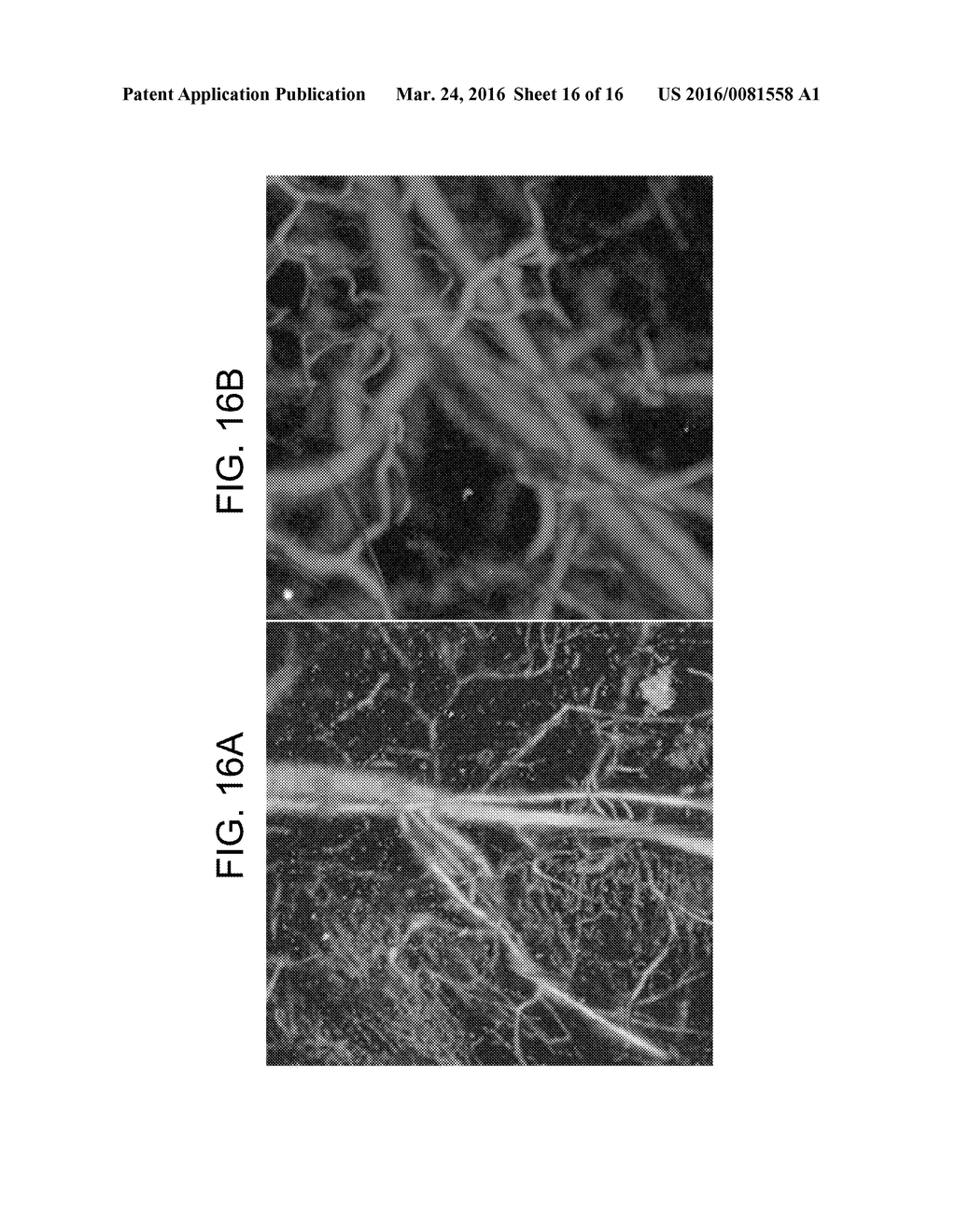 METHOD OF PHOTOACOUSTIC MICROSCOPY WITH LATERAL RESOLUTION OF     MICROVASCULATURE - diagram, schematic, and image 17