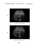 ADAPTIVE ULTRASOUND IMAGE OPTIMIZATION THROUGH AUTOMATIC GAIN CONTROL     ADJUSTMENT diagram and image