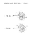 BIOPSY NEEDLE AND MEDICAL DEVICE INCORPORATING THE SAME diagram and image