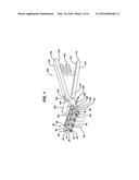 Method and Means to Attach Anchor Suture onto Mesh Implants diagram and image