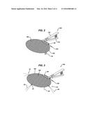 Method and Means to Attach Anchor Suture onto Mesh Implants diagram and image