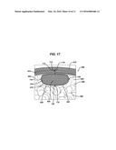 Method and Means to Attach Anchor Suture onto Mesh Implants diagram and image