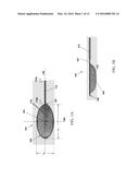 Method of Attaching A Mesh to A Coated Loop Member of A Surgical Snare     Device diagram and image