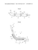 MANTLE TUBE AND TREATMENT TOOL diagram and image