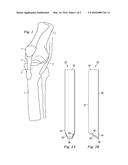 Percutaneous Fixator and Method of Insertion diagram and image