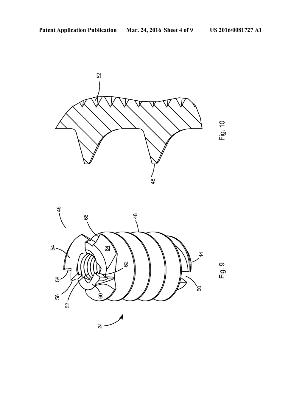 INTRAMEDULLARY COMPRESSION SCREW SYSTEM - diagram, schematic, and image 05