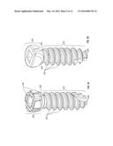 LOCKING BONE SCREWS AND METHODS OF USE THEREOF diagram and image