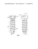 LOCKING BONE SCREWS AND METHODS OF USE THEREOF diagram and image