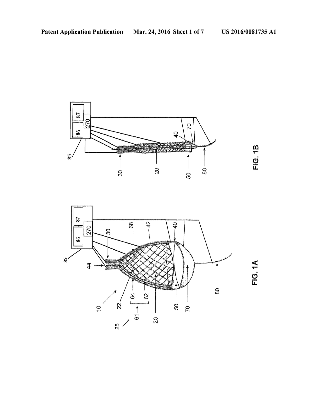 SYSTEMS AND METHODS FOR CRYOABLATION OF A TISSUE - diagram, schematic, and image 02